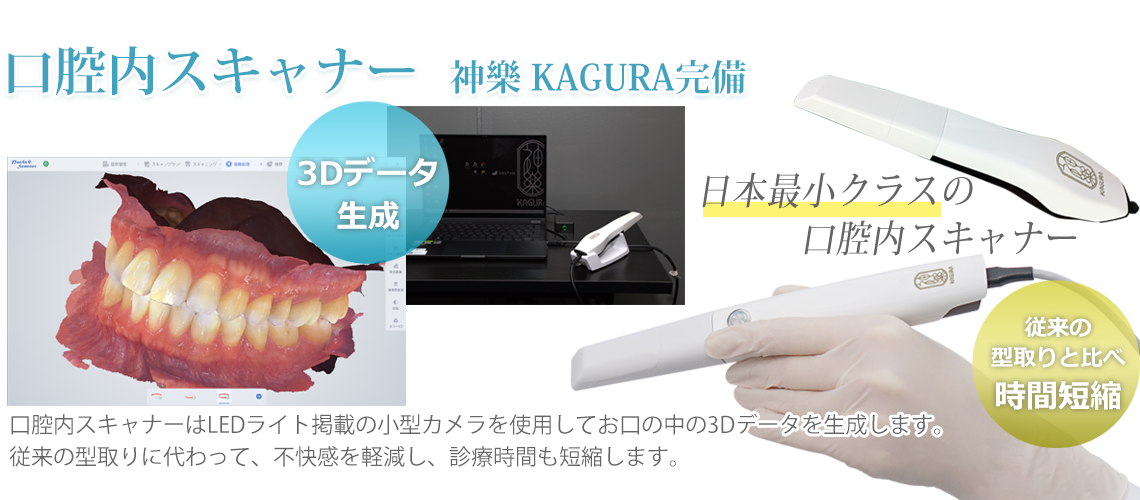 口腔内スキャナー