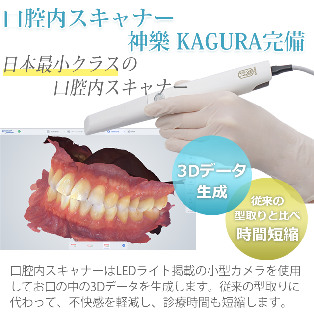 口腔内スキャナー